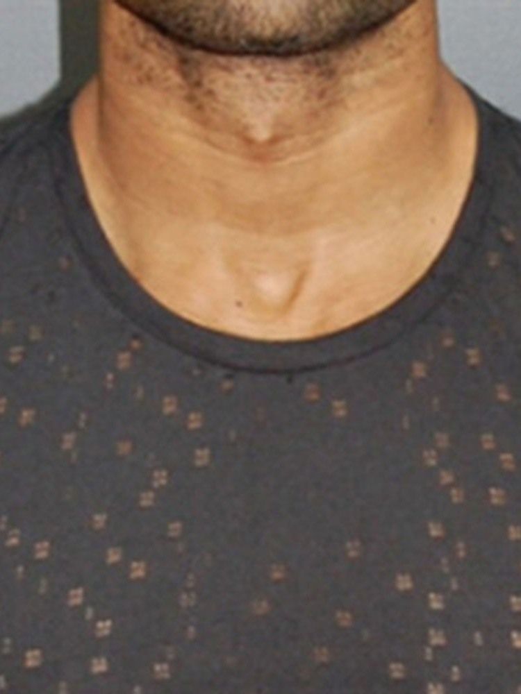 Rundhalsad Ihålig Enfärgad Kortärmad Smal T-Shirt För Män